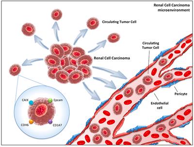 Frontiers | Circulating Tumor Cells In Renal Cell Carcinoma: Recent ...